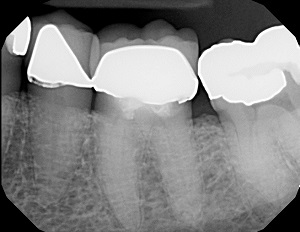 Lesen Sie mehr über den Artikel Dentaltown veröffentlicht Rückruf nach 70 Jahren