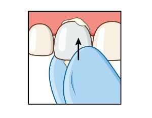 Lesen Sie mehr über den Artikel Strips Kronen in 5 einfachen Schritten