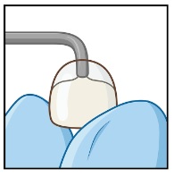Streifenkrone Abbildung 4