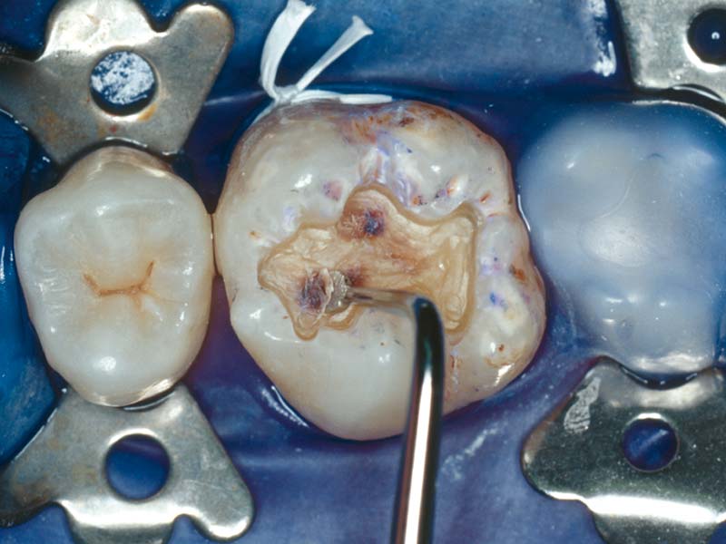clinical-procedure-snoop-3