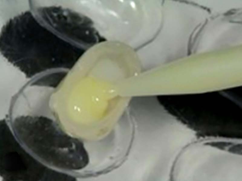 clinical-procedure2-kleer-veneer-10