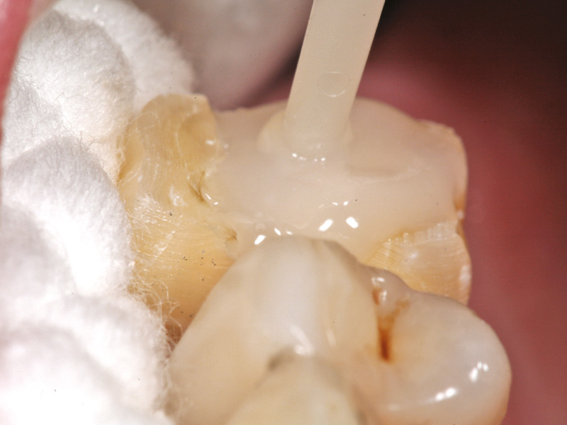 core-build-up-procedure-2024-1