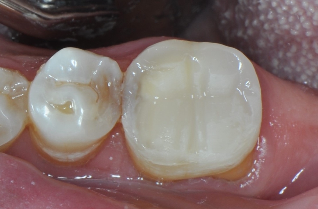 Final-restoration-rotate